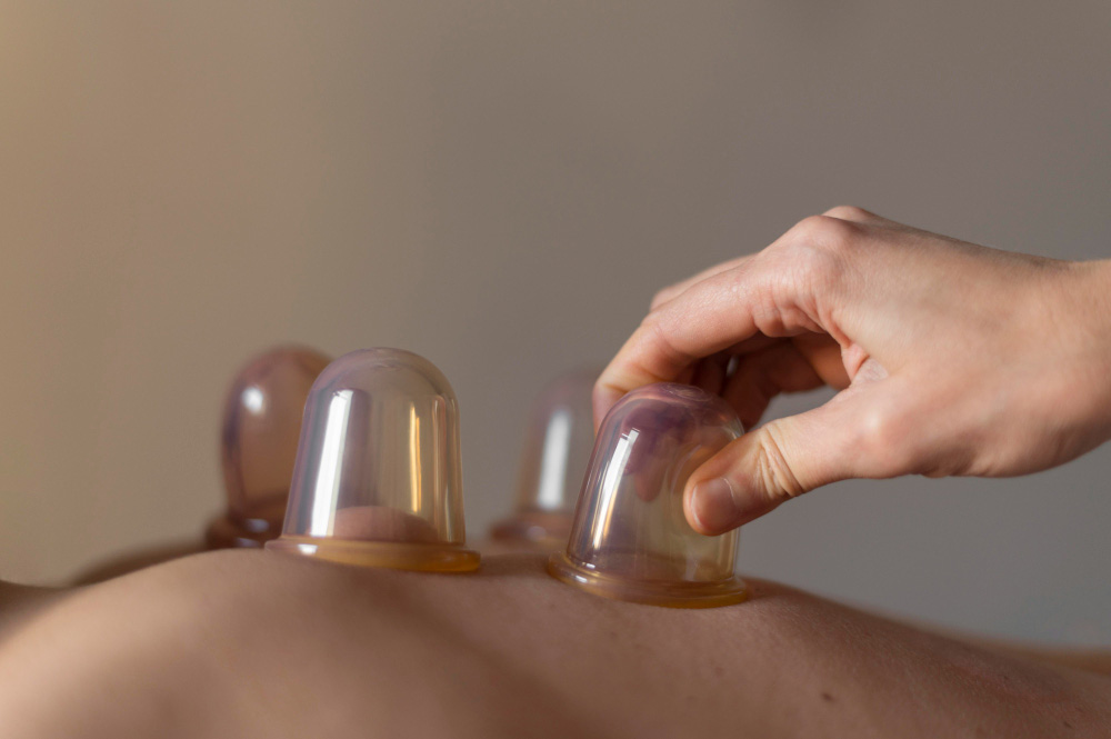 Professional cupping therapy treatment for muscle recovery and tension relief.